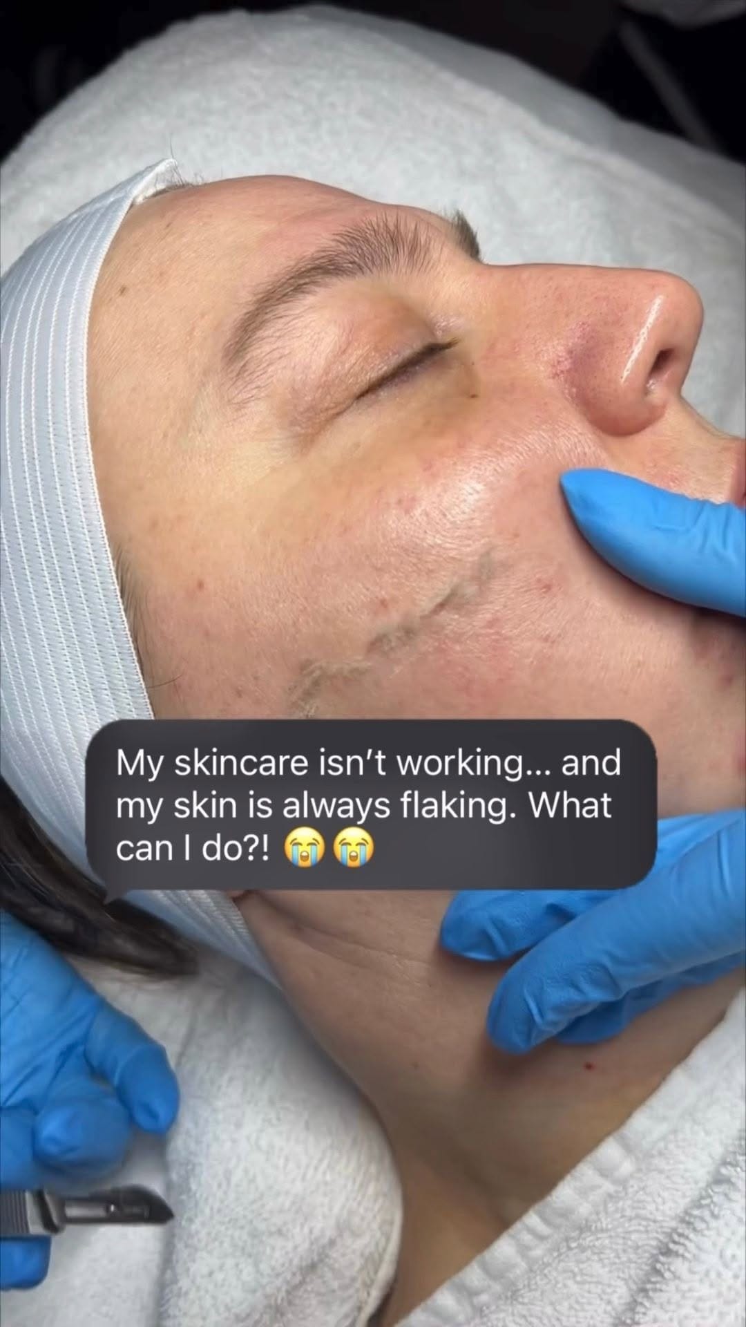 Post 9 by DermaLux Medical Aesthetics Spa on Instagram (video)