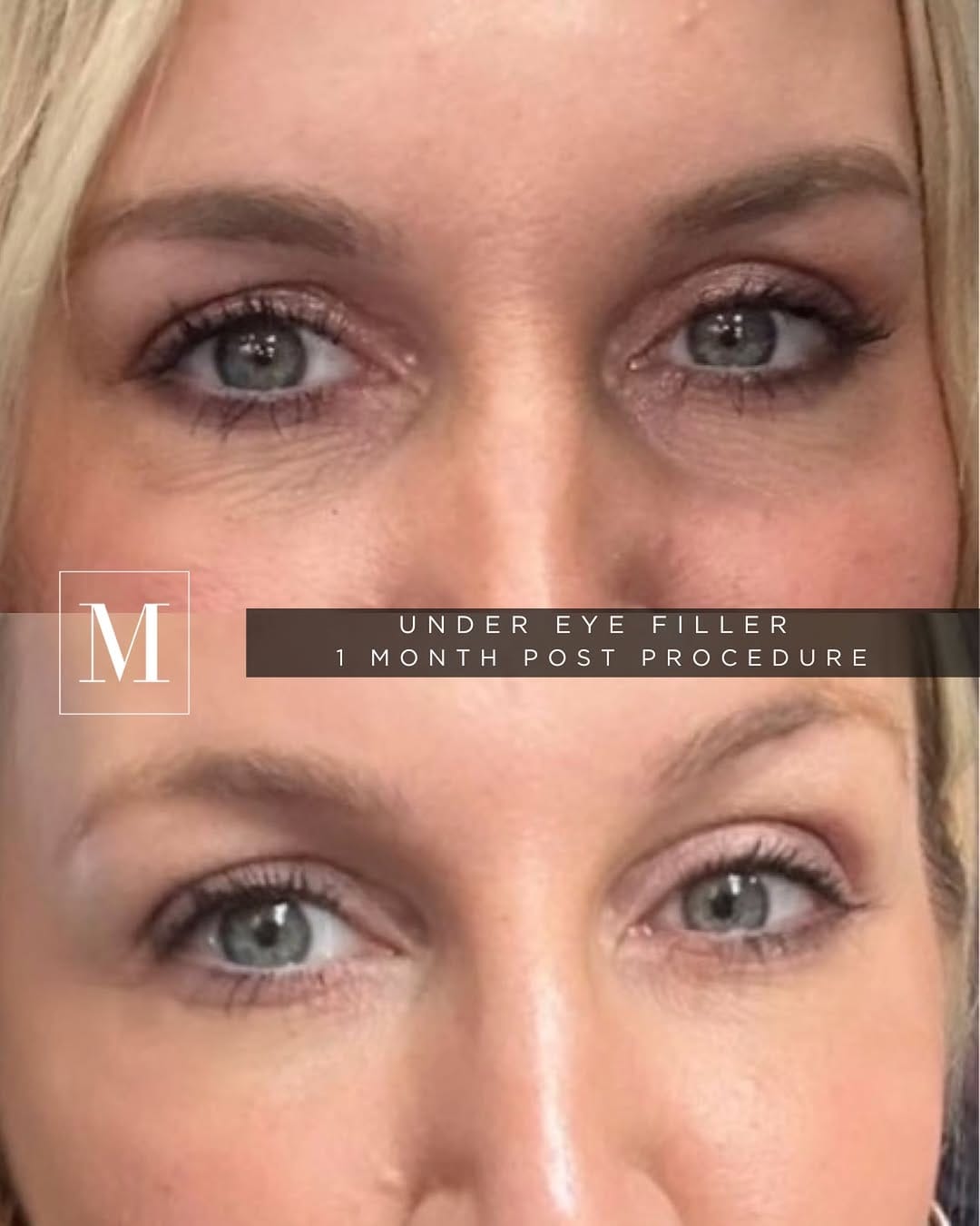 Post 3 by Monaco Medical Aesthetics on Instagram (image)