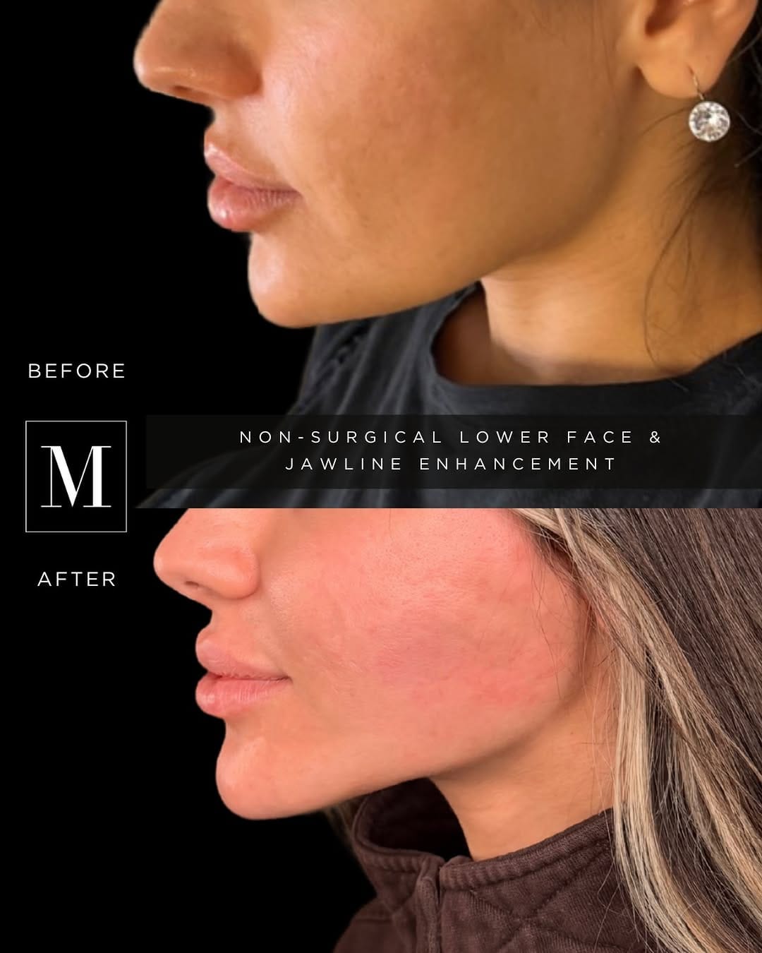 Post 10 by Monaco Medical Aesthetics on Instagram (image)