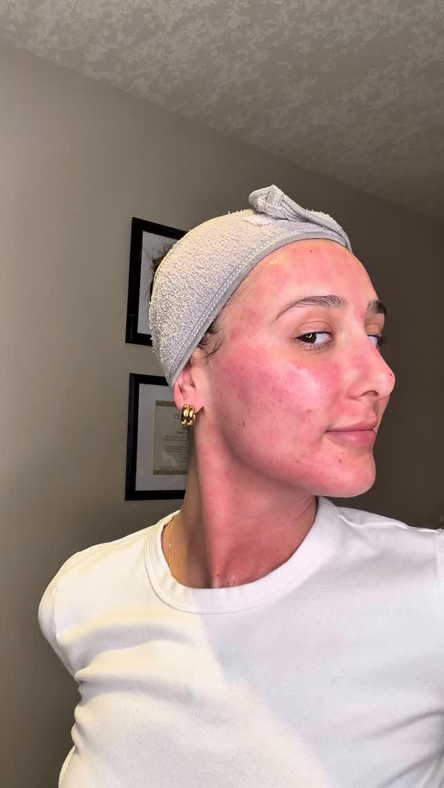 Post 4 by Monaco Medical Aesthetics on Instagram (video)