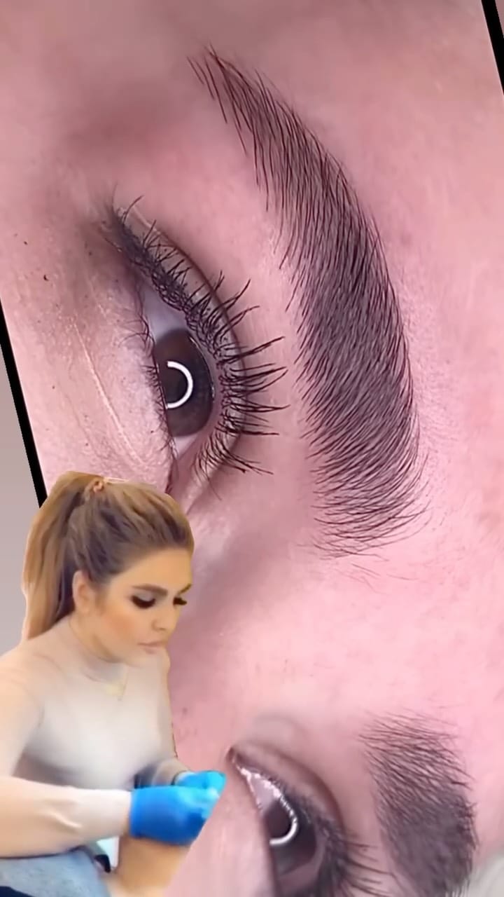 Post 5 by بنفشه مقدم/ فیبروز/ میکروبلیدینگ/ هایپر نچرال/ نانو/کرکی/ مویی on Instagram (video)