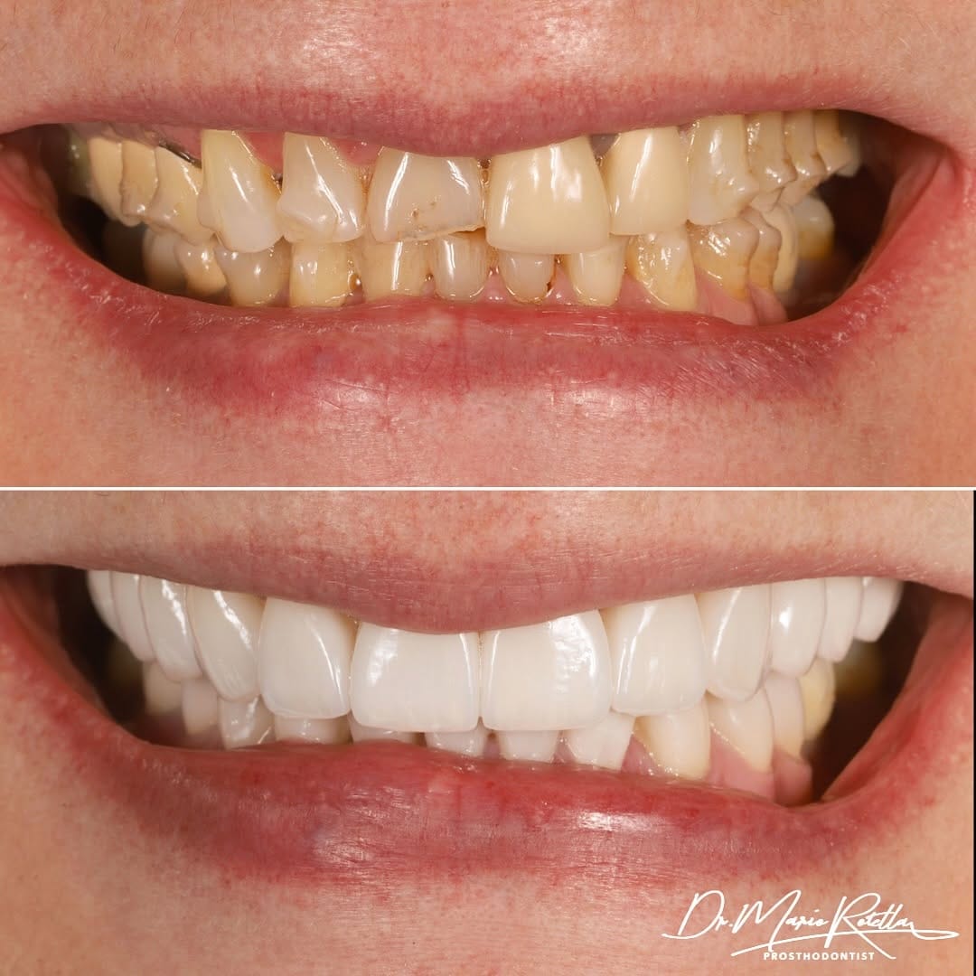 Post 6 by Dr. Mario Rotella on Instagram (image)