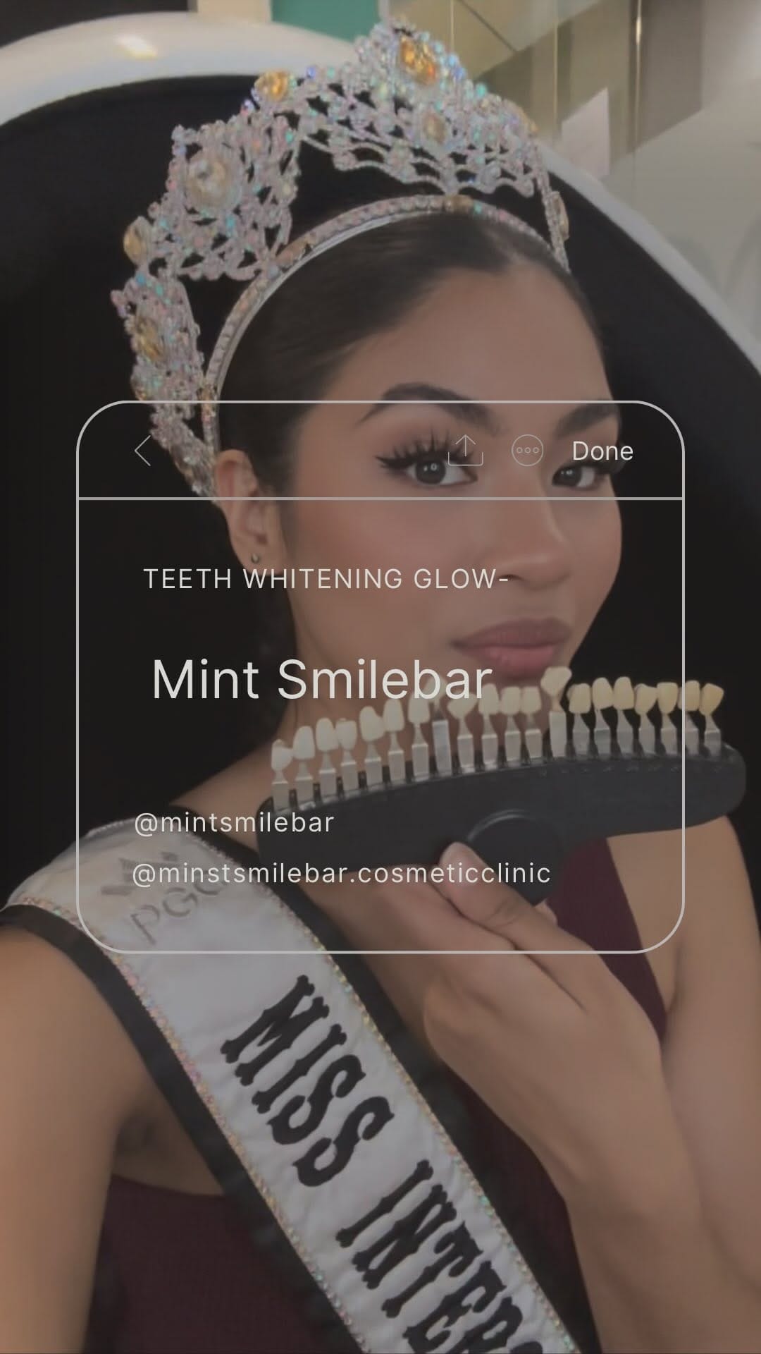 Post 6 by Mint Smilebar & Cosmetic Clinic on Instagram (video)