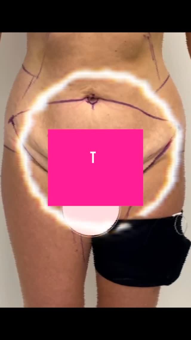 Post 3 by Dr Tim Sproule on Instagram (video)