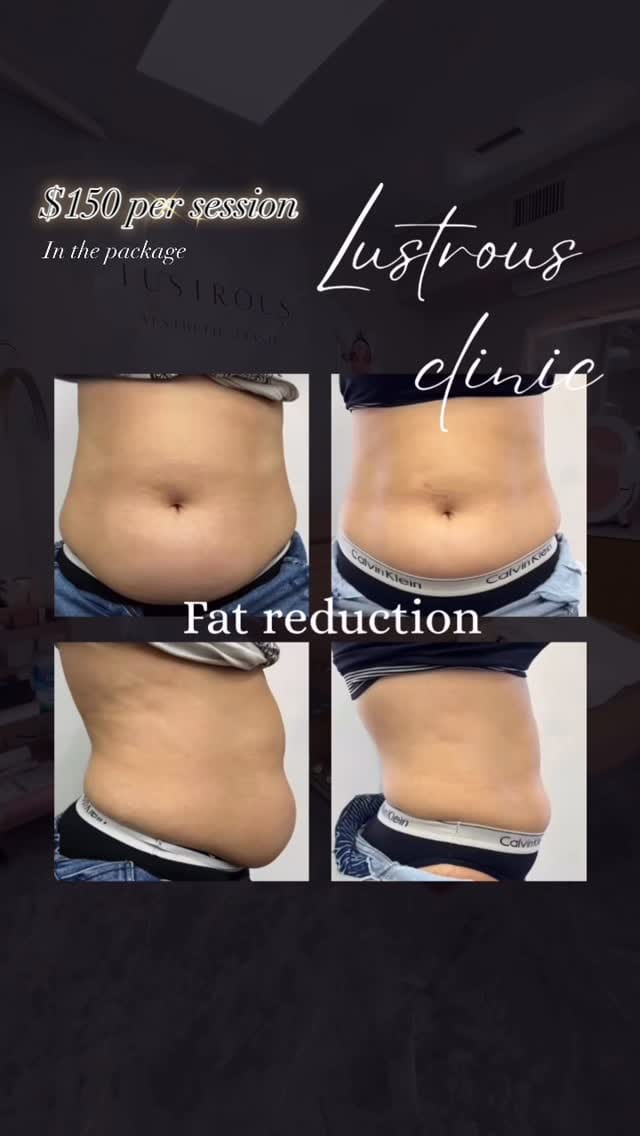 Post 1 by Lustrous aesthetic clinic on Instagram (video)