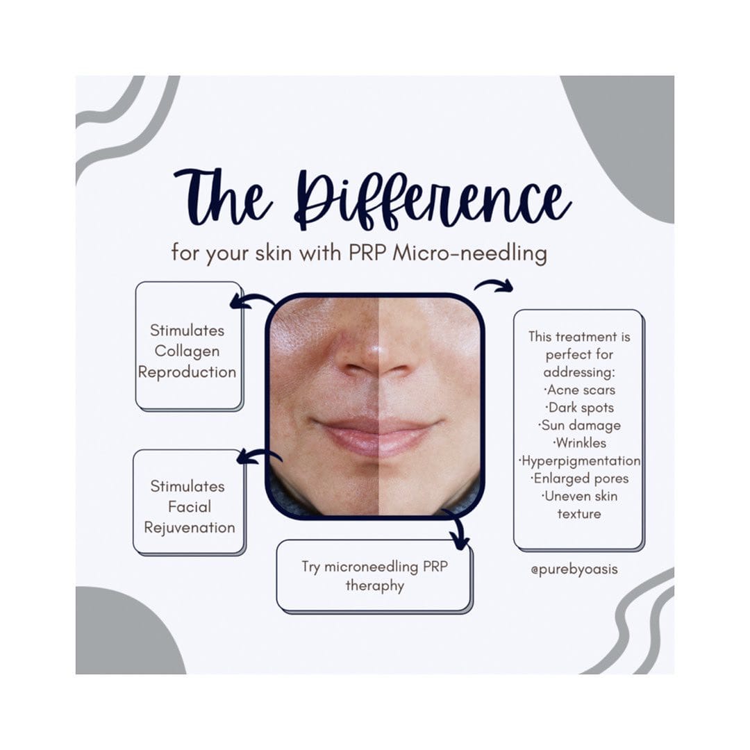 Post 6 by Pure Medical Aesthetics on Instagram (image)