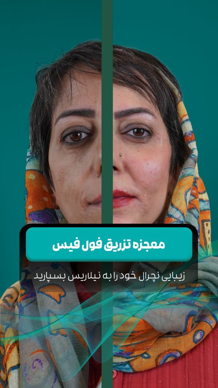 Post 4 by دکتر سروش رجایی ن.پ ۱۵۵۷۳۶ on Instagram (video)