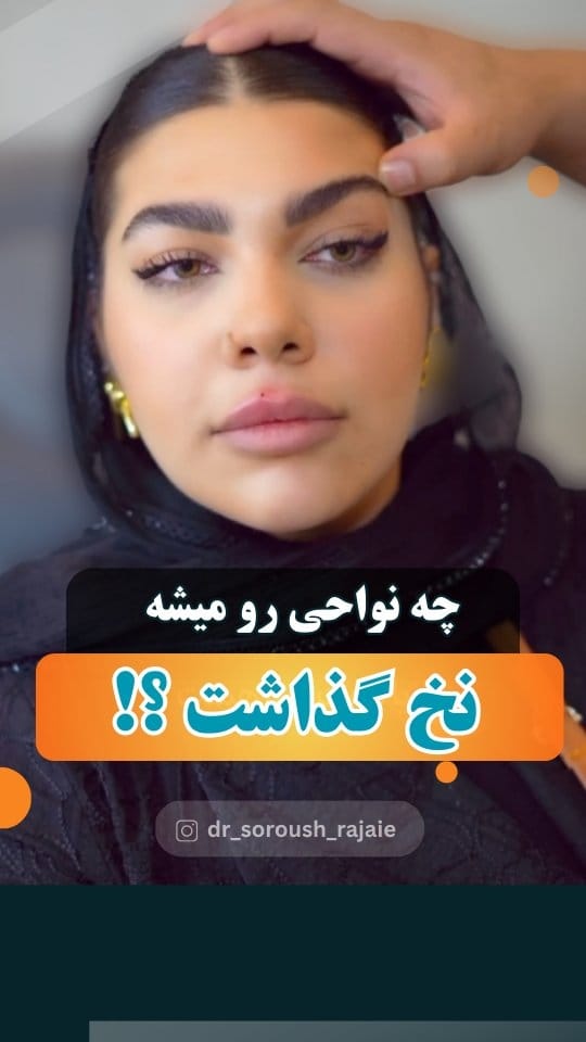 Post 9 by دکتر سروش رجایی ن.پ ۱۵۵۷۳۶ on Instagram (video)