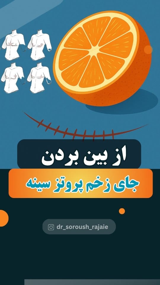 Post 6 by دکتر سروش رجایی ن.پ ۱۵۵۷۳۶ on Instagram (video)