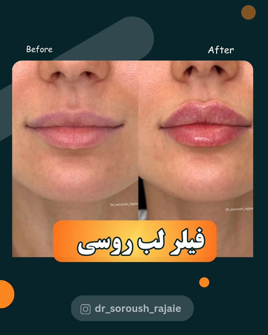 Post 8 by دکتر سروش رجایی ن.پ ۱۵۵۷۳۶ on Instagram (image)