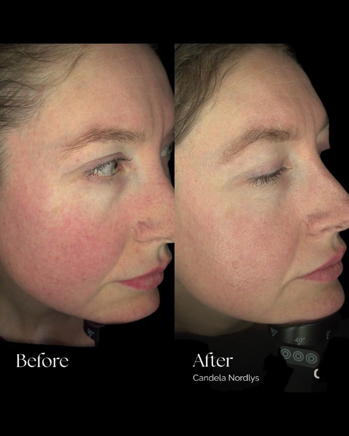 Post 2 by Sparkle Lifestyle & MediSpa | Holistic Beauty on Instagram (image)