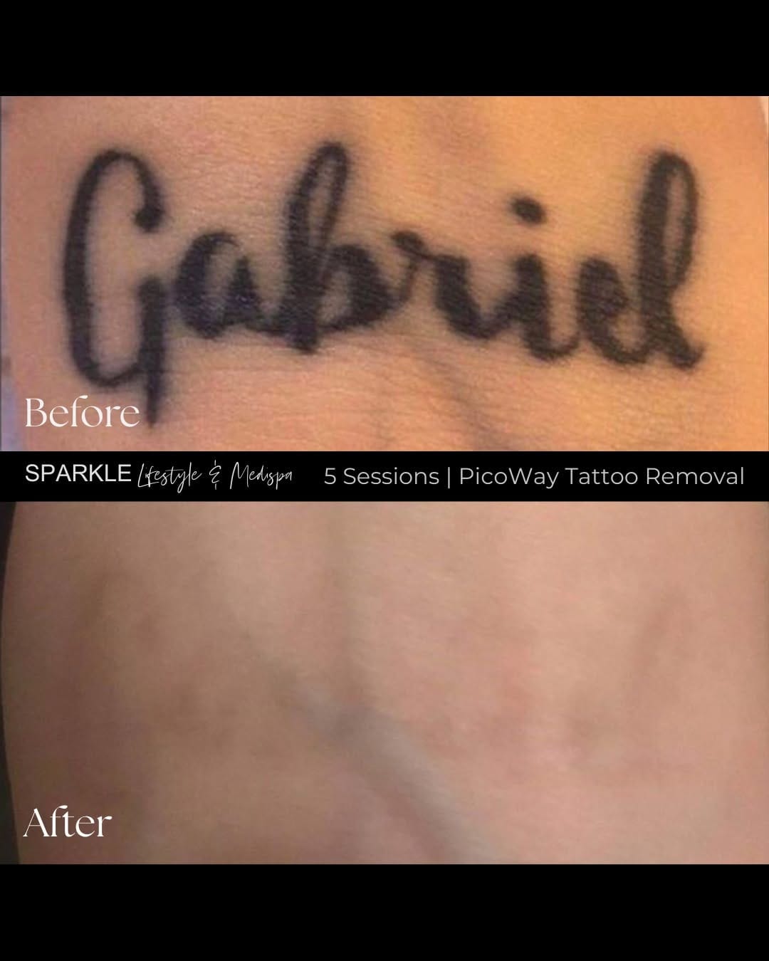 Post 9 by Sparkle Lifestyle & MediSpa | Holistic Beauty on Instagram (image)