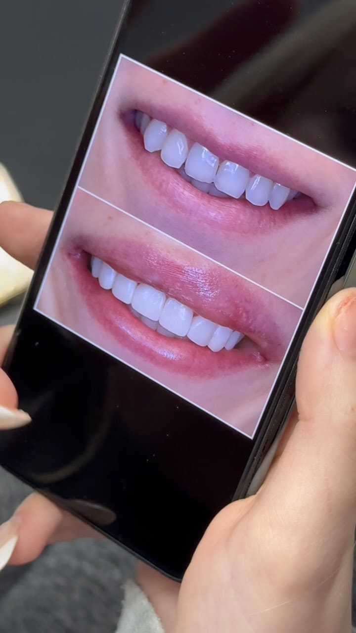 Post 8 by Dr Shannon Hobbs, DMD on Instagram (video)