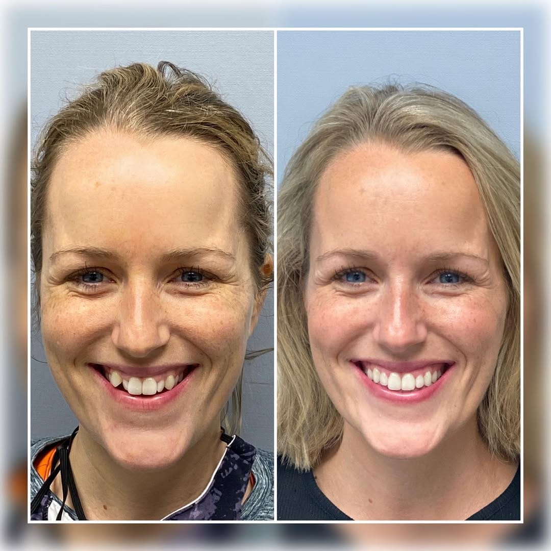 Post 10 by Dr Shannon Hobbs, DMD on Instagram (carousel)