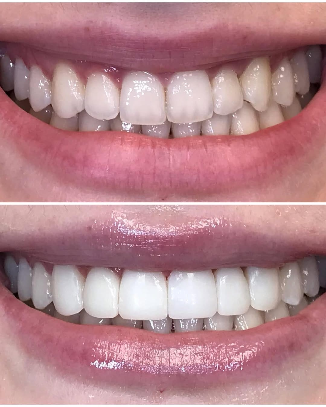 Post 9 by Dr Shannon Hobbs, DMD on Instagram (carousel)
