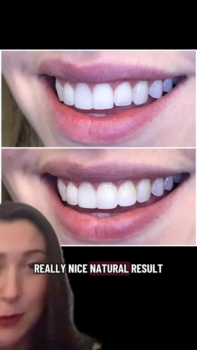 Post 5 by Dr Shannon Hobbs, DMD on Instagram (video)