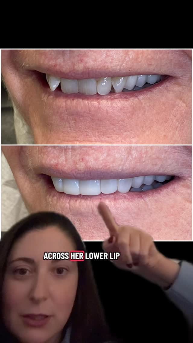 Post 4 by Dr Shannon Hobbs, DMD on Instagram (video)