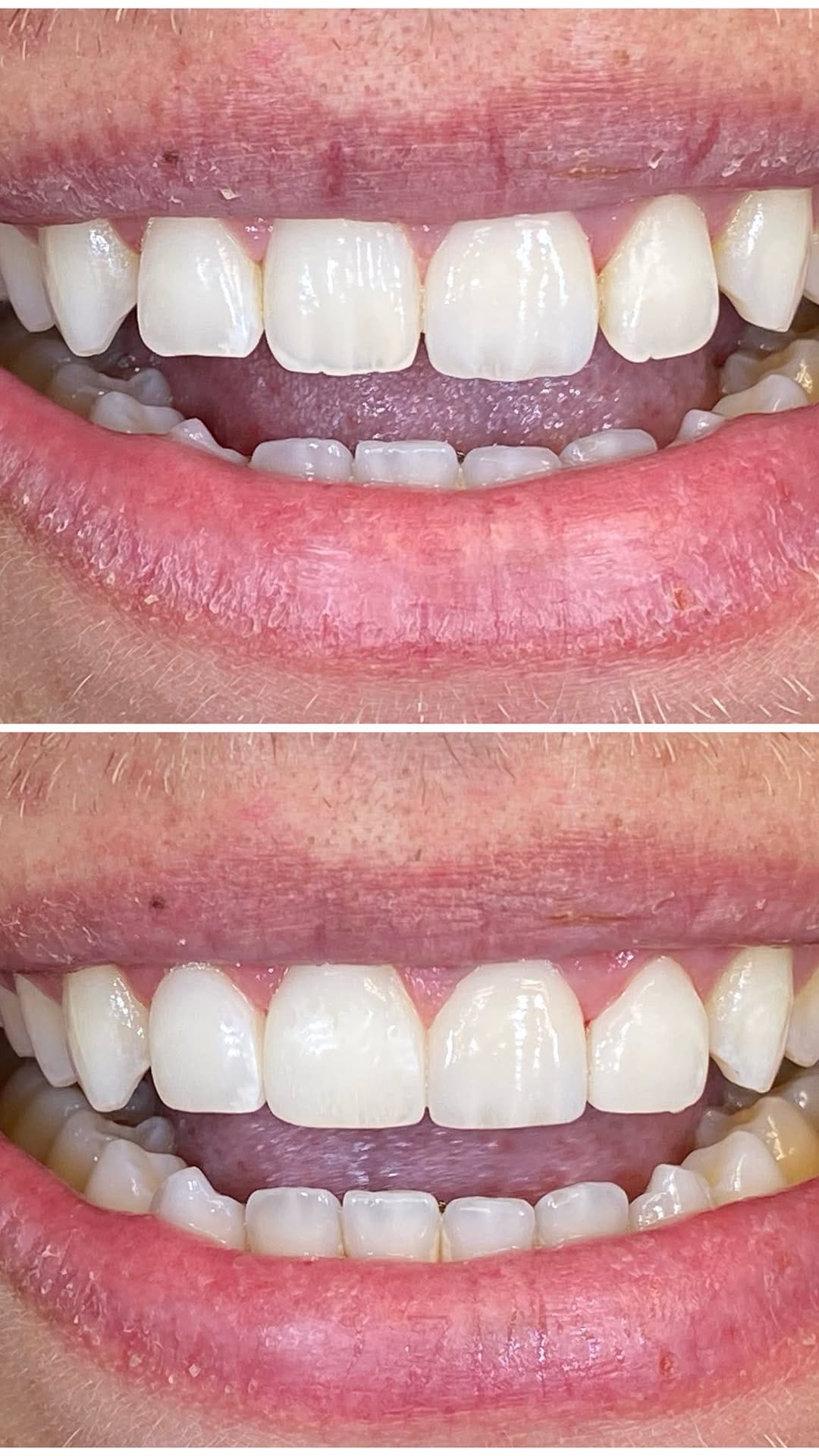 Post 1 by Dr Shannon Hobbs, DMD on Instagram (video)