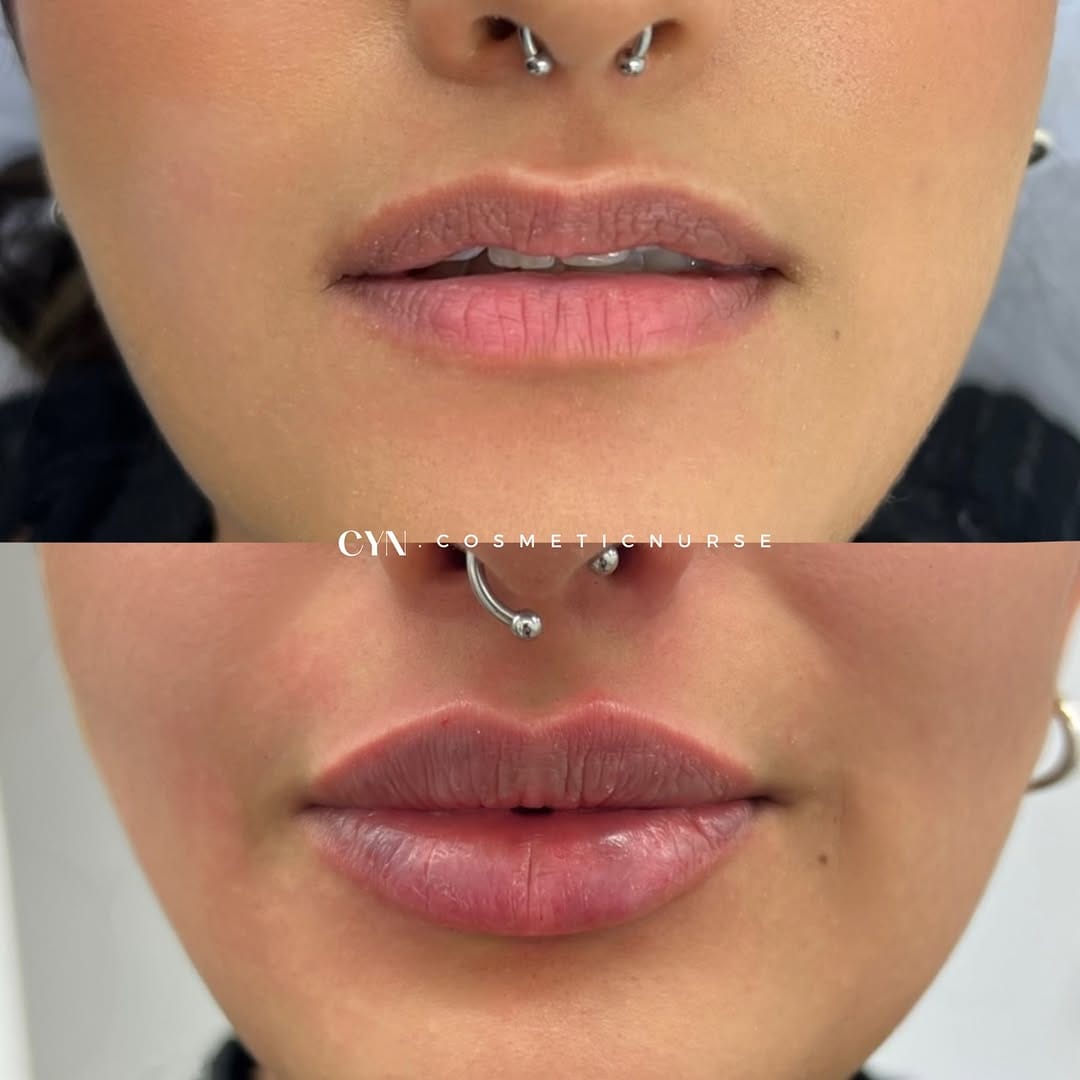 Post 2 by Nurse Cynthia 💋🇮🇹🇨🇦🇱🇧 on Instagram (image)