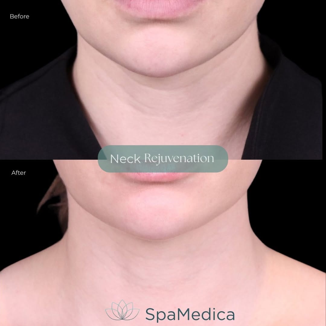 Post 6 by Yorkville Medspa on Instagram (image)