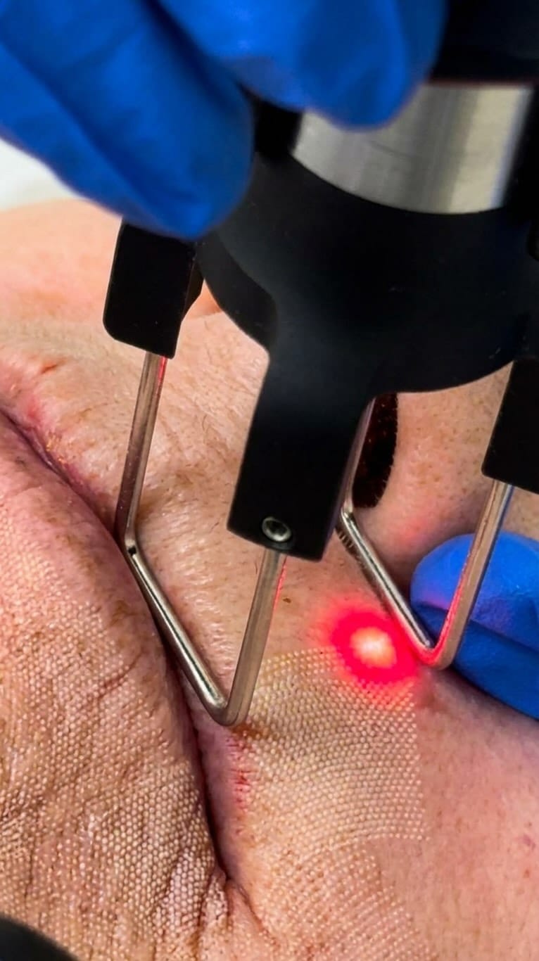 Post 7 by Yorkville Medspa on Instagram (video)