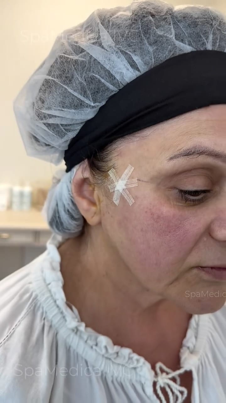 Post 4 by Yorkville Medspa on Instagram (video)