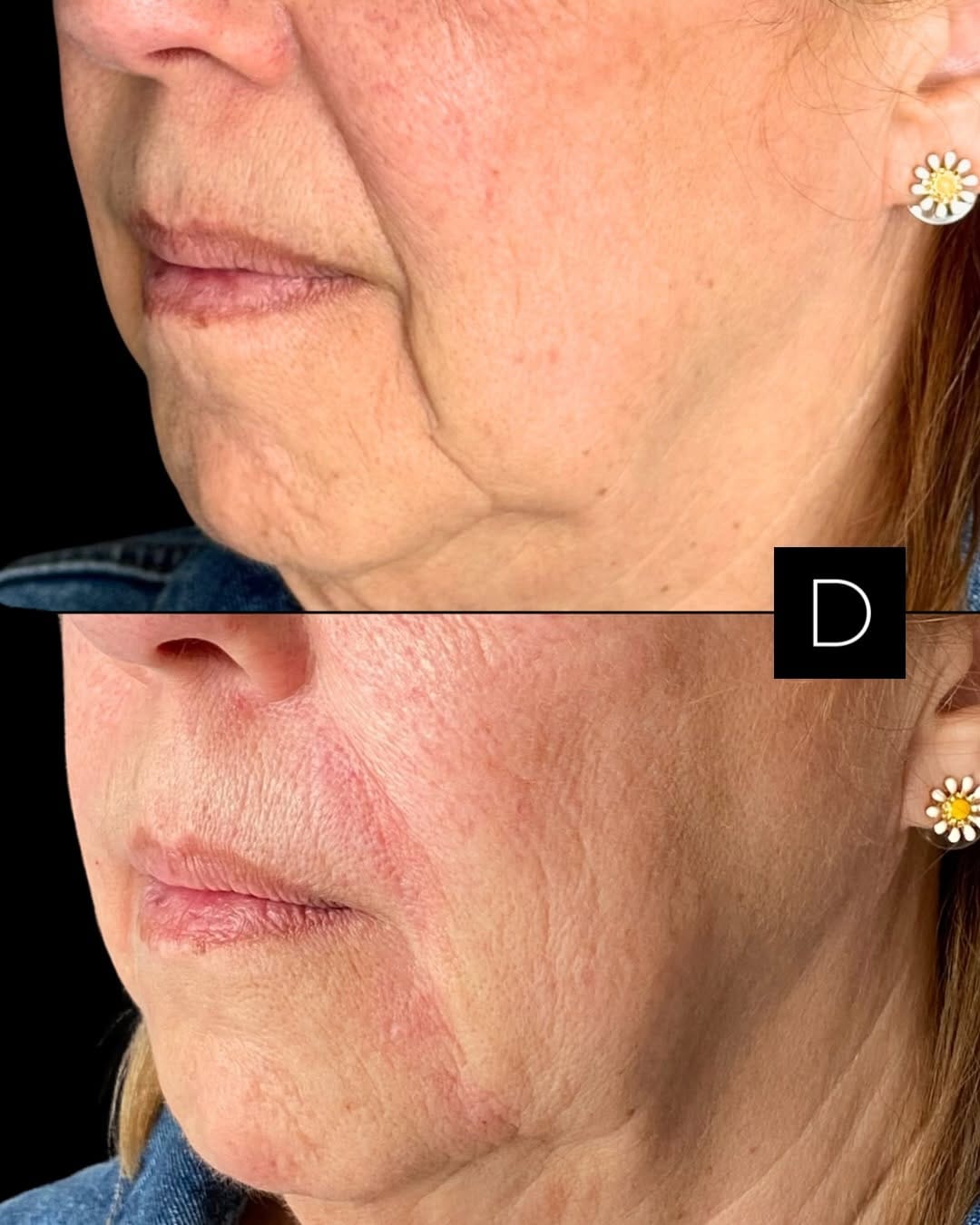 Post 6 by Asmaa Kabouya | Botox, Fillers on Instagram (carousel)