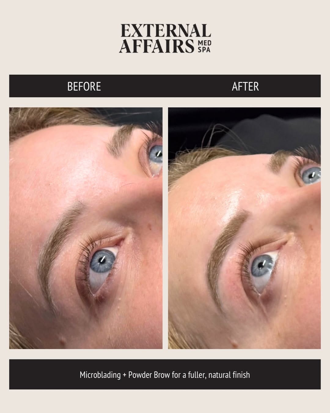 Post 7 by EA Med Spa | 30+ Years of Injection + Skin Expertise on Instagram (carousel)