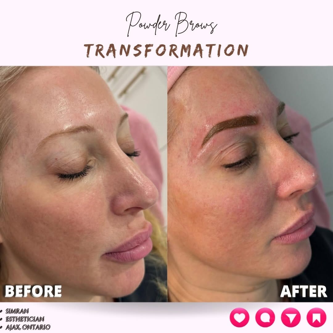 Post 3 by Farah Chahine | 📍Botox & Fillers Injector Vaughan & Ajax on Instagram (carousel)