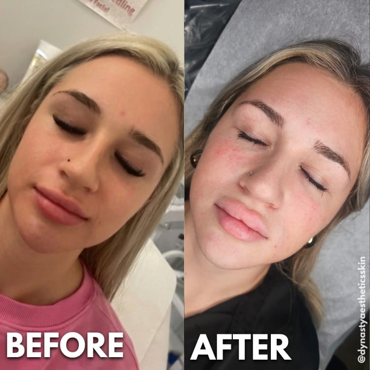 Post 2 by Farah Chahine | 📍Botox & Fillers Injector Vaughan & Ajax on Instagram (image)