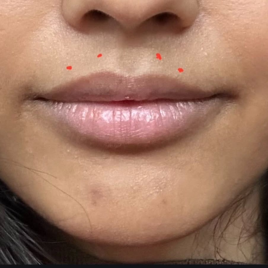 Post 5 by EBS Permanent Makeup Clinic 🇬🇷🇨🇦 on Instagram (carousel)