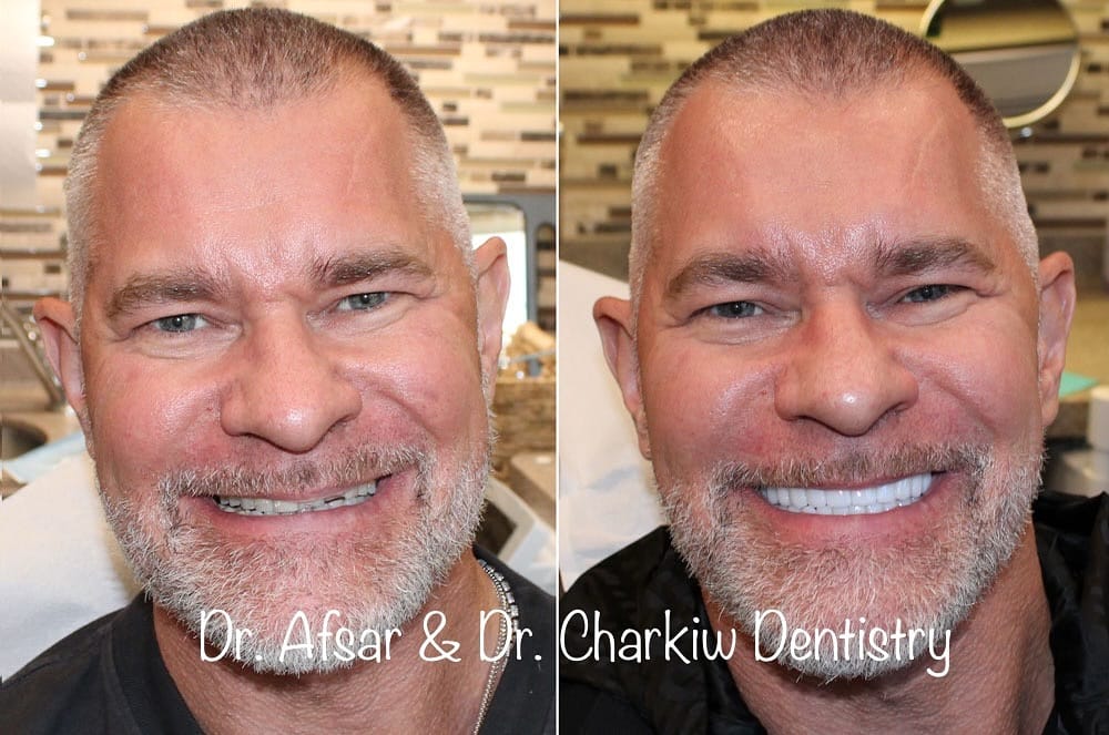 Post 4 by Veneers Toronto ™️ on Instagram (image)