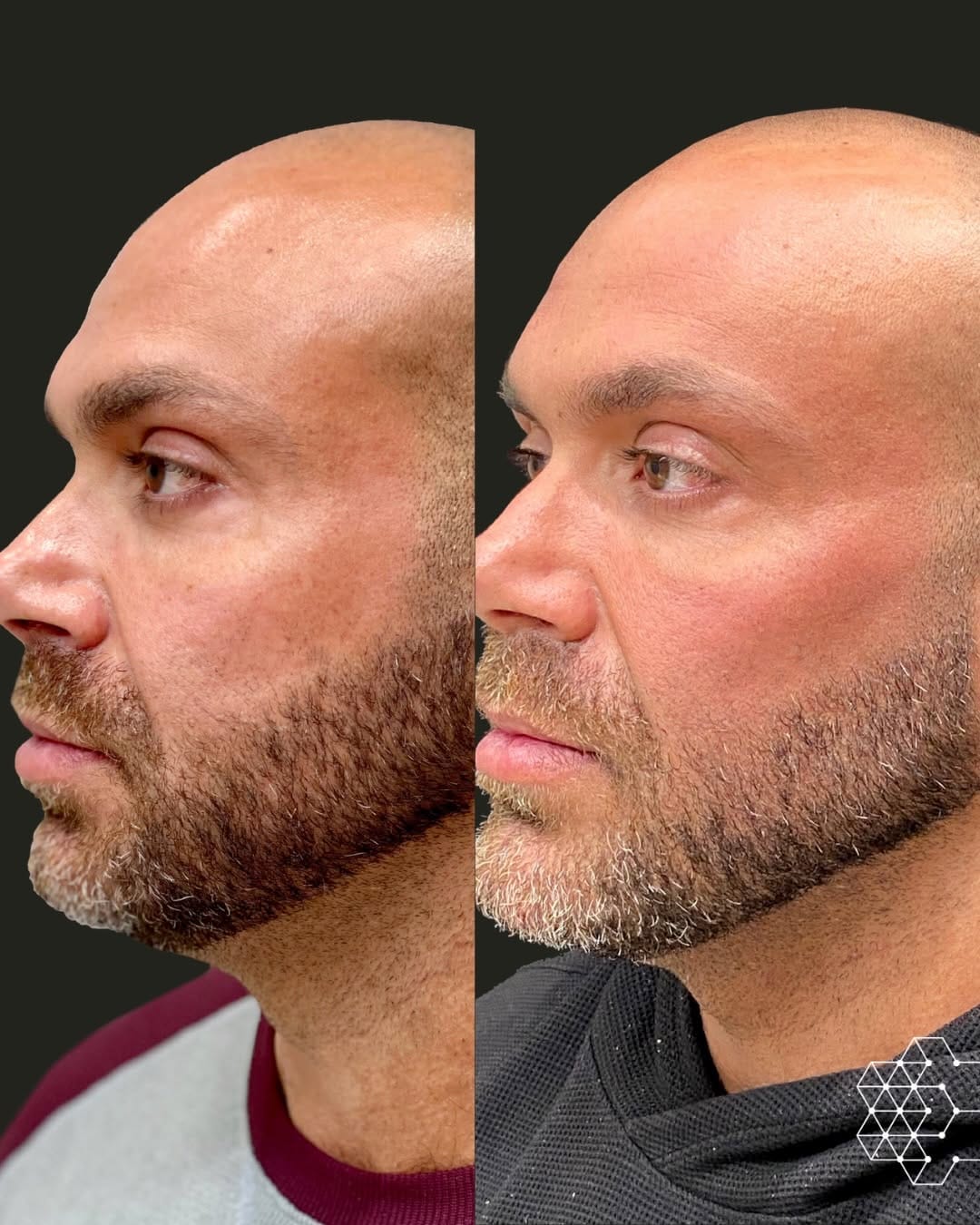 Post 1 by Skin Technique on Instagram (carousel)