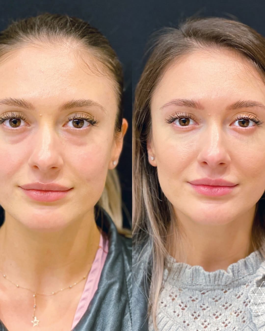 Post 10 by Skin Technique on Instagram (carousel)