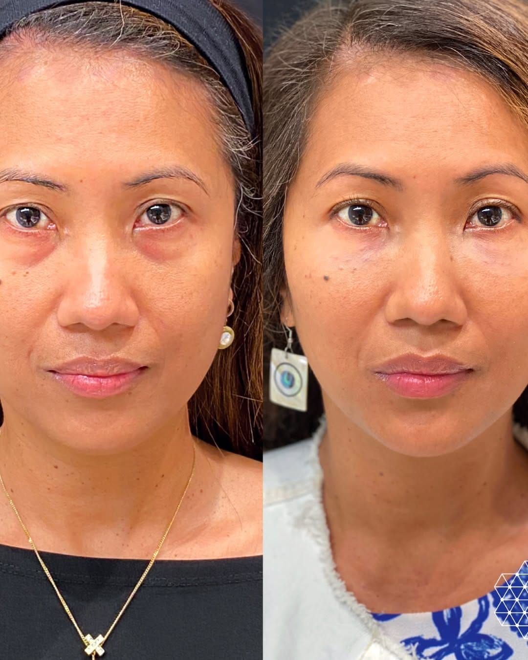 Post 4 by Skin Technique on Instagram (carousel)
