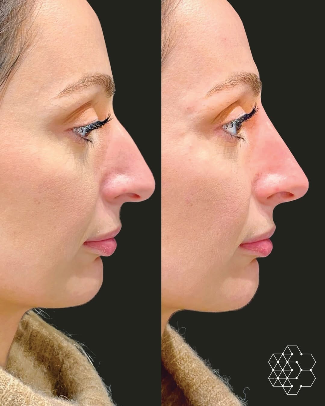 Post 7 by Skin Technique on Instagram (carousel)