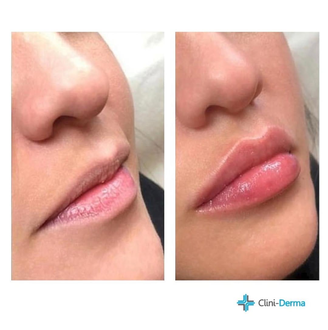 Post 10 by Clini-Derma on Instagram (image)