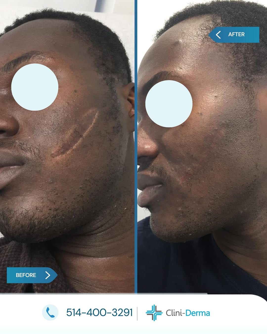 Post 4 by Clini-Derma on Instagram (image)