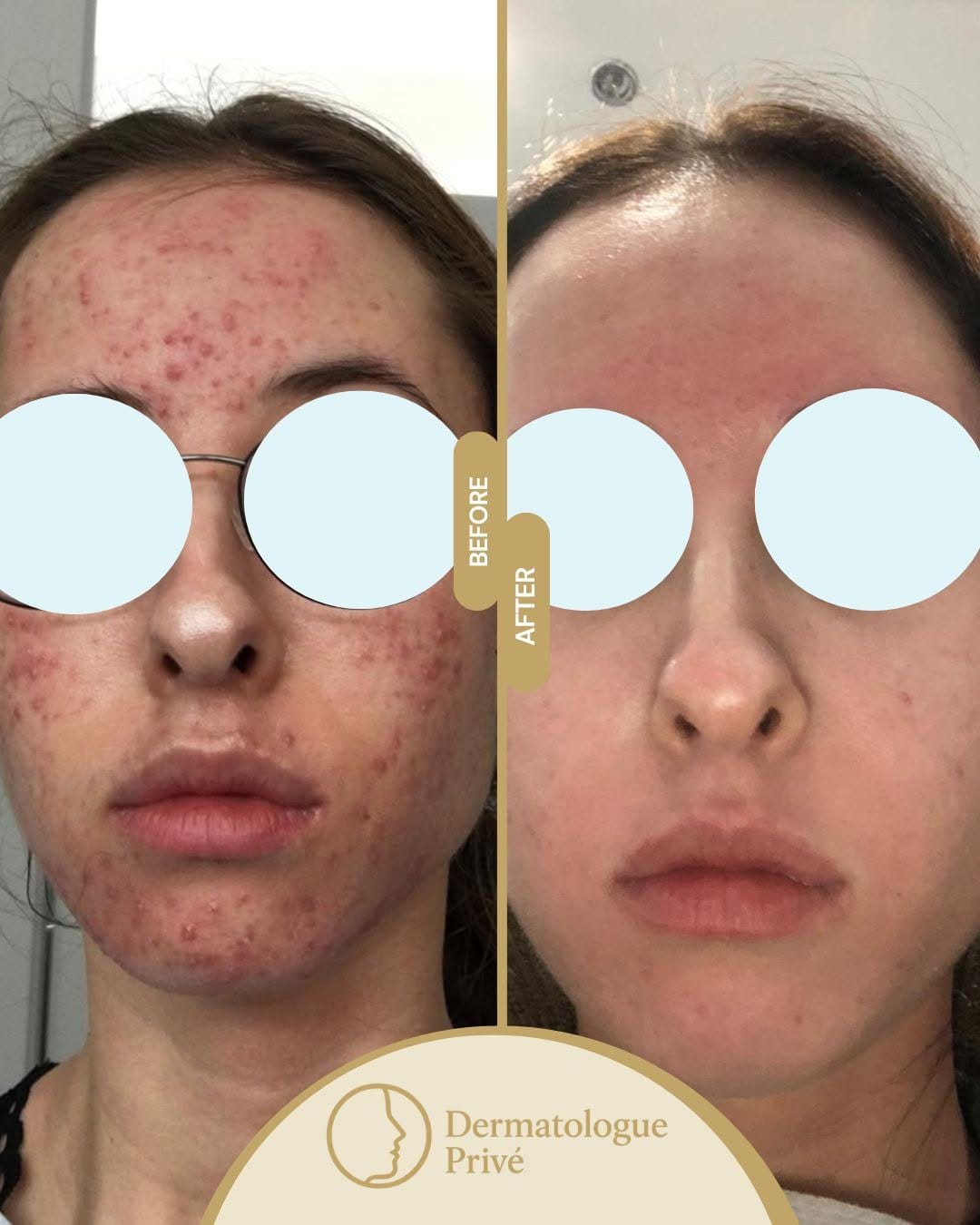 Post 1 by Clini-Derma on Instagram (image)