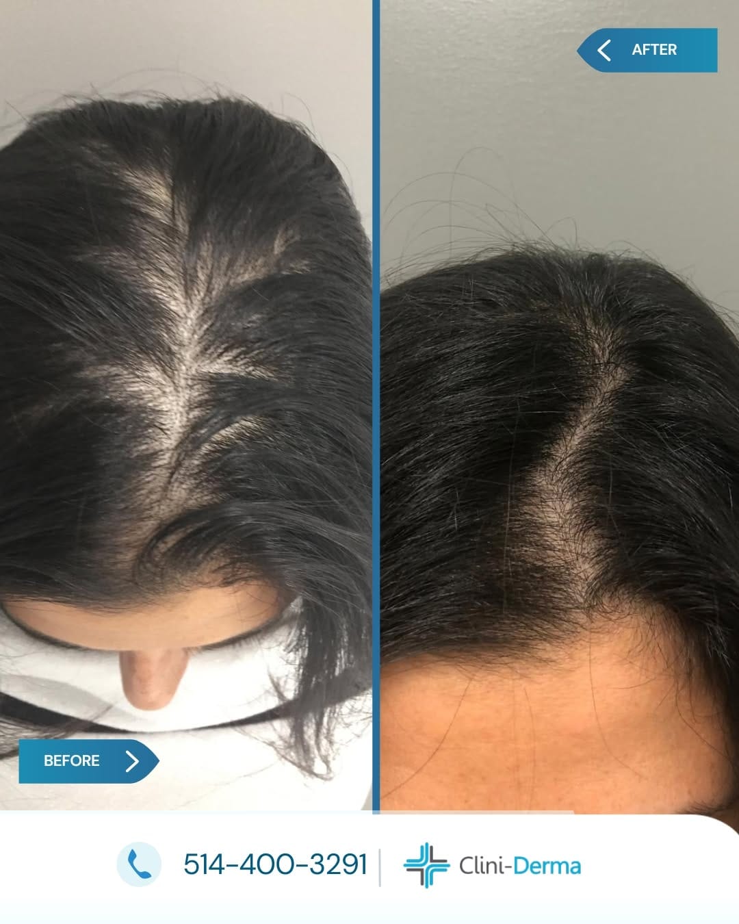 Post 2 by Clini-Derma on Instagram (image)