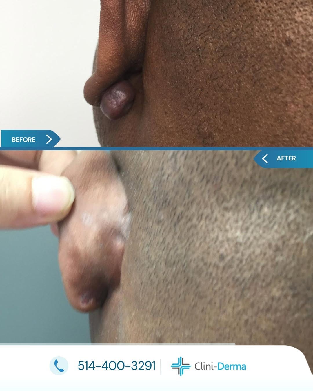 Post 5 by Clini-Derma on Instagram (image)