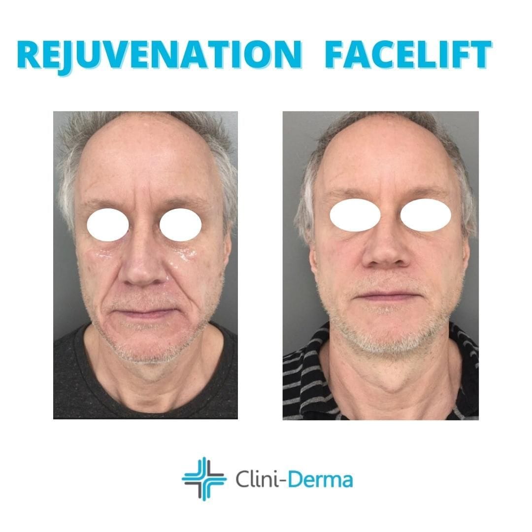 Post 9 by Clini-Derma on Instagram (image)