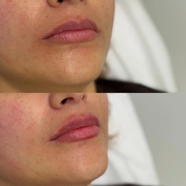 Post 4 by Dr. Payman Dehghani on Instagram (video)