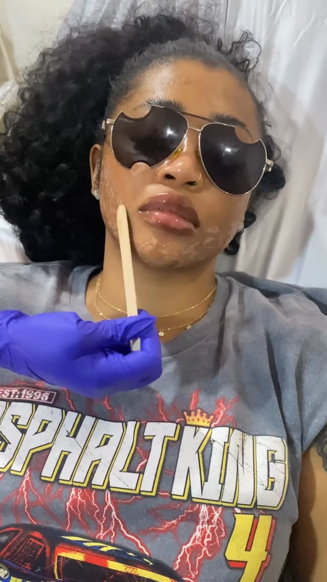 Post 5 by PEAU SAINE MEDICAL AESTHETICS🇨🇦 🇳🇬 on Instagram (video)