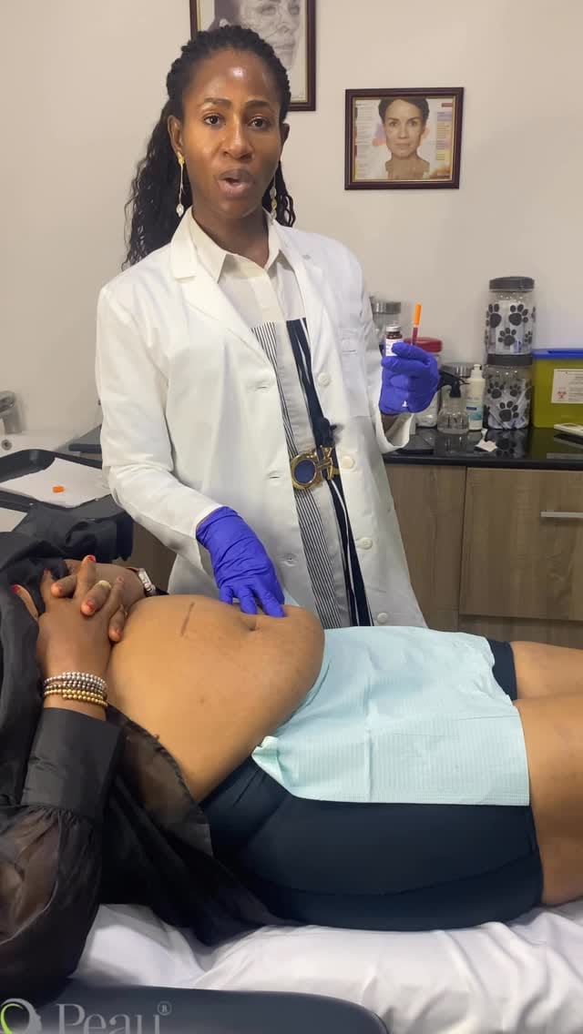 Post 3 by PEAU SAINE MEDICAL AESTHETICS🇨🇦 🇳🇬 on Instagram (video)