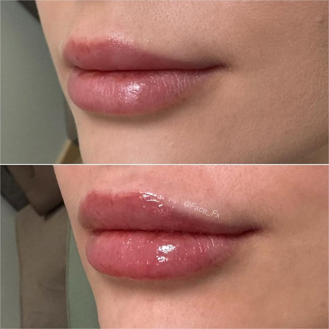 Post 4 by FACE FX MEDICAL SPA on Instagram (image)