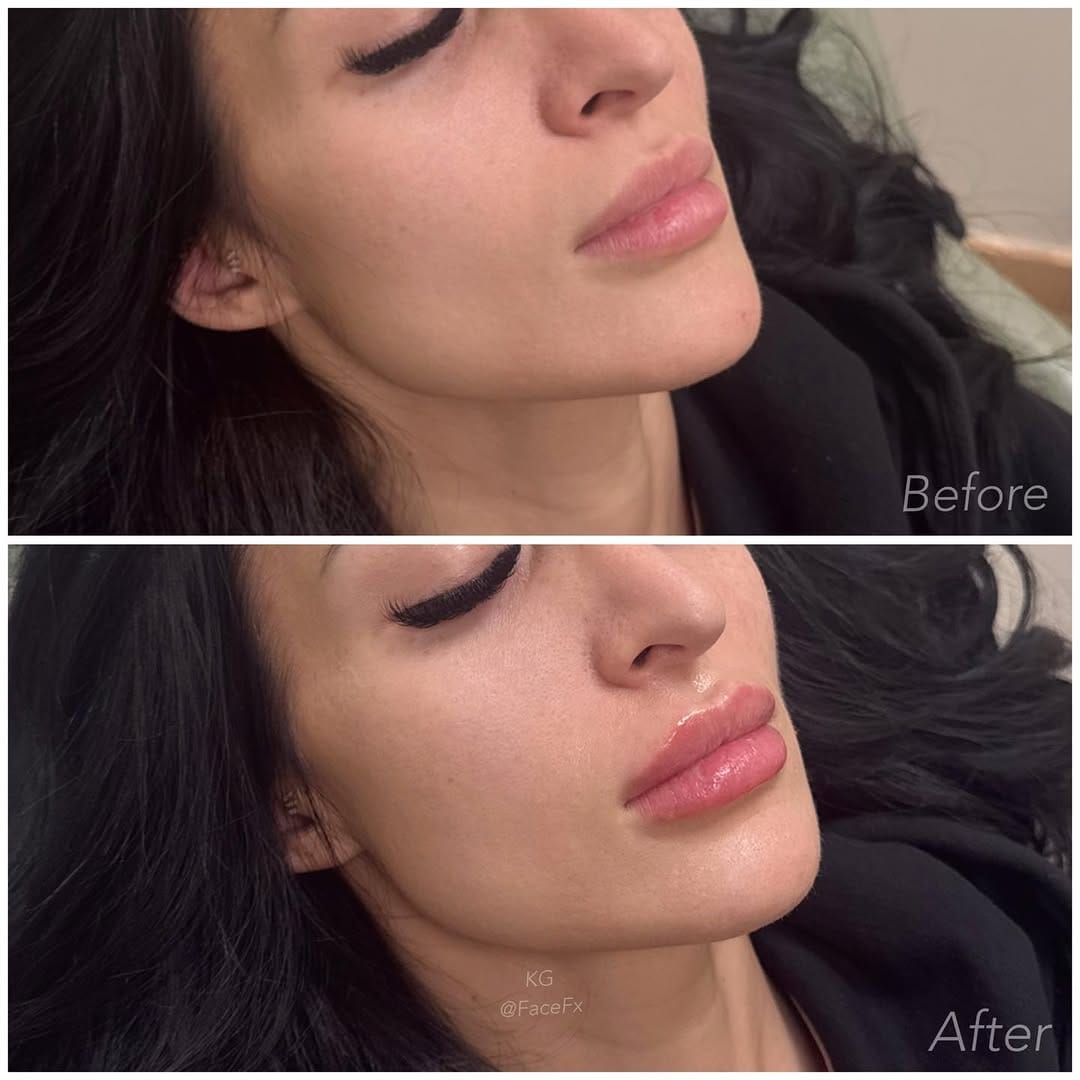 Post 7 by FACE FX MEDICAL SPA on Instagram (carousel)
