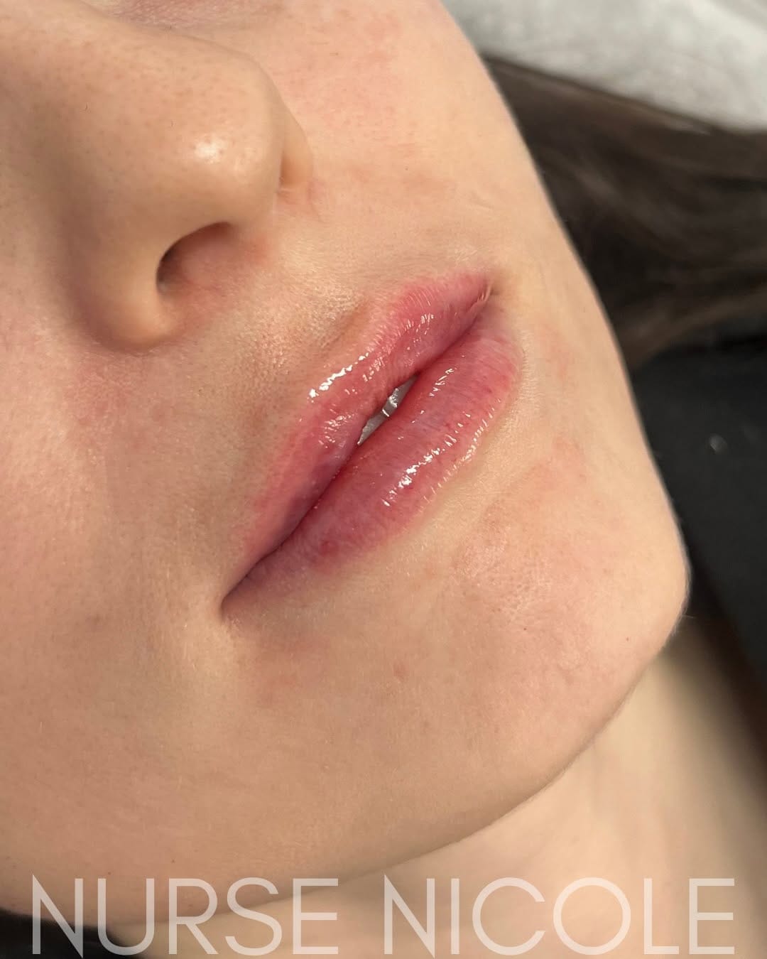 Post 7 by Beauty Bar Medical Clinics on Instagram (carousel)