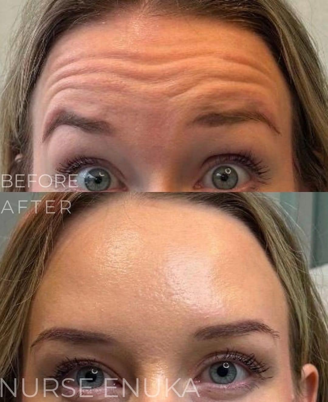 Post 5 by Beauty Bar Medical Clinics on Instagram (image)
