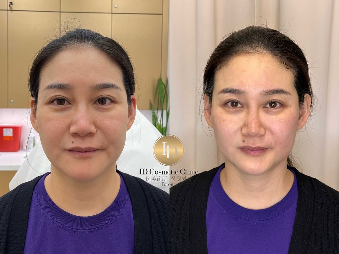 Post 3 by ID Cosmetic Clinic on Instagram (carousel)